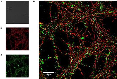 Caspase-3 Activation Correlates With the Initial Mitochondrial Membrane Depolarization in Neonatal Cerebellar Granule Neurons